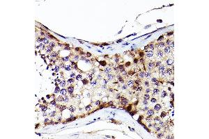 Immunohistochemistry of paraffin-embedded Human testis using S antibody (ABIN7270138) at dilution of 1:200 (40x lens). (SALL4 Antikörper  (AA 853-1053))