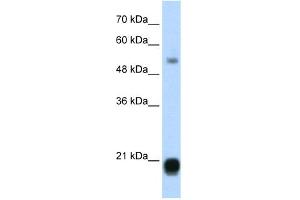 WB Suggested Anti-CBX3 Antibody Titration:  1. (CBX3 Antikörper  (Middle Region))