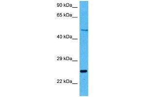 Host:  Mouse  Target Name:  PAX6  Sample Tissue:  Mouse Kidney  Antibody Dilution:  1ug/ml (PAX6 Antikörper  (N-Term))
