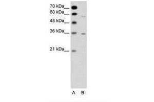 Image no. 1 for anti-G Protein-Coupled Receptor, Family C, Group 5, Member A (GPRC5A) (C-Term) antibody (ABIN6736330) (GPRC5A Antikörper  (C-Term))