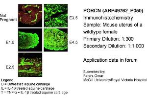 Immunohistochemistry (IHC) image for anti-Porcupine Homolog (PORCN) (N-Term) antibody (ABIN2783888) (PORCN Antikörper  (N-Term))