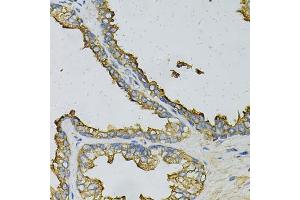 Immunohistochemistry of paraffin-embedded human prostate using RPLP0 Antibody (ABIN6290910) at dilution of 1:100 (40x lens). (RPLP0 Antikörper)