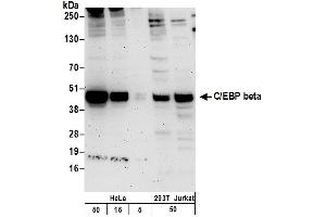 Western Blotting (WB) image for anti-CCAAT/enhancer Binding Protein (C/EBP), beta (CEBPB) (AA 50-100) antibody (ABIN7454861)