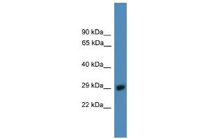 WB Suggested Anti-PSMD9 Antibody Titration: 0. (PSMD9 Antikörper  (C-Term))