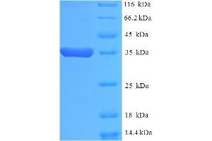 SDS-PAGE (SDS) image for Eukaryotic Translation Elongation Factor 1 epsilon 1 (EEF1E1) (AA 2-174) protein (His-SUMO Tag) (ABIN5709435) (EEF1E1 Protein (AA 2-174) (His-SUMO Tag))