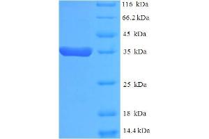 SDS-PAGE (SDS) image for Eukaryotic Translation Elongation Factor 1 epsilon 1 (EEF1E1) (AA 2-174) protein (His-SUMO Tag) (ABIN5709435)