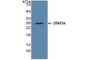 Figure. (Cyclin B1 Antikörper  (AA 239-433))