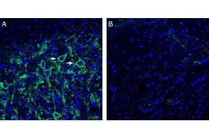Expression of Neuroligin-3 in rat deep cerebellar nuclei. (Neuroligin 3 Antikörper  (Extracellular, N-Term))