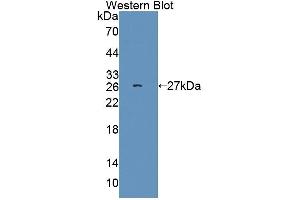 Western blot analysis of the recombinant protein. (SRSF1 Antikörper  (AA 16-224))