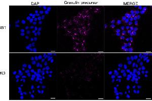Immunocytochemical staining of HeLa cells using Granulin precursor antibody (ABIN7798800), 1:1,000), Top panel: wild-type (WT), Bottom panal: Granulin precursor shRNA knockdown (KD).