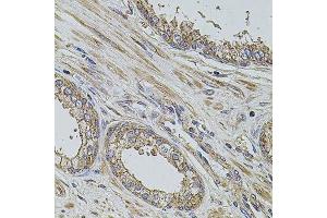 Immunohistochemistry (Paraffin-embedded Sections) (IHC (p)) image for anti-Programmed Cell Death 6 Interacting Protein (PDCD6IP) (AA 1-180) antibody (ABIN1512565)