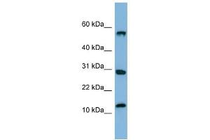 SRP19 antibody used at 1 ug/ml to detect target protein. (SRP19 Antikörper  (Middle Region))