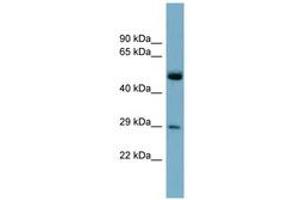 Image no. 1 for anti-RAB27A, Member RAS Oncogene Family (RAB27A) (C-Term) antibody (ABIN6741985) (RAB27A Antikörper  (C-Term))