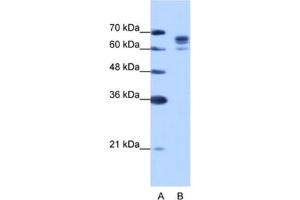 Western Blotting (WB) image for anti-DEAD (Asp-Glu-Ala-Asp) Box Polypeptide 17 (DDX17) antibody (ABIN2462307) (DDX17 Antikörper)