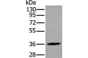 Western blot analysis of Jurkat cell lysate using ACAT2 Polyclonal Antibody at dilution of 1:550 (ACAT2 Antikörper)