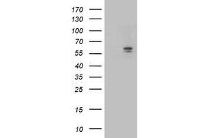 Western Blotting (WB) image for anti-Aldehyde Dehydrogenase 3 Family, Member A2 (ALDH3A2) antibody (ABIN1496594) (ALDH3A2 Antikörper)