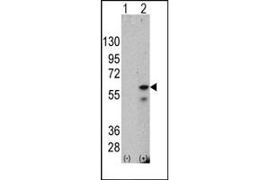 Western Blotting (WB) image for anti-PTEN Induced Putative Kinase 1 (PINK1) antibody (ABIN356392) (PINK1 Antikörper)