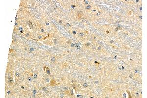 ABIN6258972 and ABIN6275963 at 1/100 staining Rat brain tissue by IHC-P. (GPR173 Antikörper  (Internal Region))