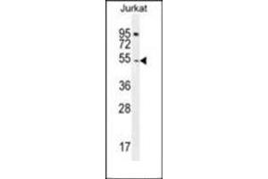Western blot analysis of DARS1 Antibody (N-term) in Jurkat cell line lysates (35ug/lane). (DARS Antikörper  (N-Term))