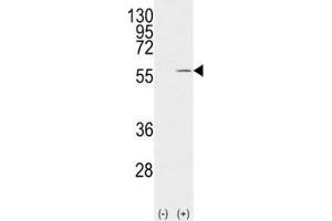 Western blot analysis of Vimentin antibody and 293 cell lysate (2 ug/lane) either nontransfected (Lane 1) or transiently transfected with the VIM gene (2). (Vimentin Antikörper  (AA 63-90))