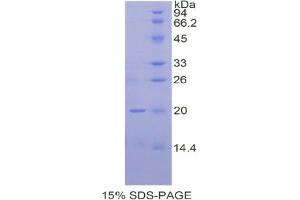 SDS-PAGE analysis of Human IHH Protein. (Indian Hedgehog Protein (IHH))