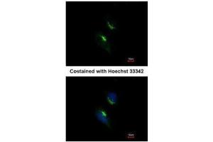 ICC/IF Image Immunofluorescence analysis of methanol-fixed HeLa, using PRPS1, antibody at 1:200 dilution. (PRPS1 Antikörper)