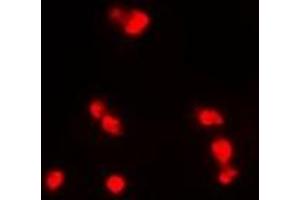 Immunofluorescent analysis of INI1 staining in MCF7 cells. (SMARCB1 Antikörper)