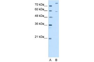 CROT antibody used at 2. (CROT Antikörper  (N-Term))