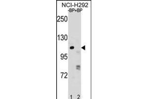RP1 Antibody (N-term) (ABIN1881627 and ABIN2838811) pre-incubated without(lane 1) and with(lane 2) blocking peptide in NCI- cell line lysate.