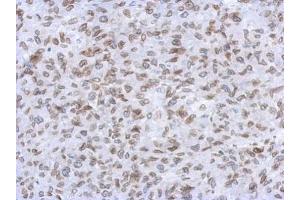 IHC-P Image Immunohistochemical analysis of paraffin-embedded RT2 xenograft, using Lamin A + C, antibody at 1:500 dilution.