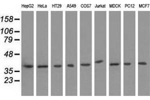 Western blot analysis of extracts (35 µg) from 9 different cell lines by using anti-HIBCH monoclonal antibody. (HIBCH Antikörper)