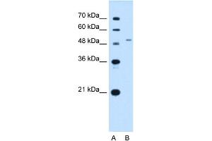 WB Suggested Antibody Titration:  2. (SLC29A2 Antikörper  (N-Term))