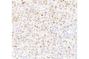 Immunohistochemistry (IHC) image for anti-Tumor Protein P53 Binding Protein 1 (TP53BP1) (AA 350-400) antibody (ABIN7453568)