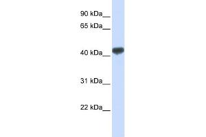 WB Suggested Anti-ZRANB2 Antibody Titration:  0. (ZNF265 Antikörper  (N-Term))