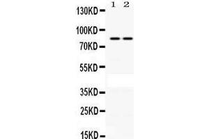 Observed bind size: 85KD (PLA2G4A Antikörper  (C-Term))