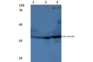 Western blot(WB) analysis of p-IkB-α antibody (NFKBIA Antikörper  (pTyr42))