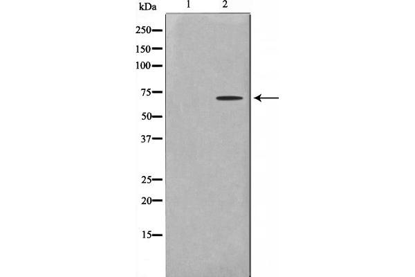 GTF2H2 Antikörper  (N-Term)