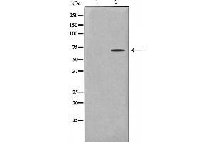 Western blot analysis on COLO205 cell lysate using TF2H2 Antibody,The lane on the left is treated with the antigen-specific peptide. (GTF2H2 Antikörper  (N-Term))