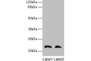 Western blot All lanes: LGALS9C antibody at 4 μg/mL Lane 1: Mouse stomach tissue Lane 2: Mouse liver tissue Secondary Goat polyclonal to rabbit IgG at 1/10000 dilution Predicted band size: 40 kDa Observed band size: 22 kDa (LGALS9C Antikörper  (AA 1-356))