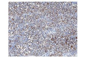 IHC analysis of ARF6 using anti-ARF6 antibody (ABIN4886473).