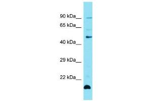 Host:  Rabbit  Target Name:  Zfp27  Sample Type:  Mouse Thymus lysates  Antibody Dilution:  1. (Zinc Finger Protein 27 (ZFP27) (Middle Region) Antikörper)