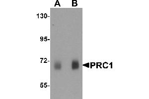 Western blot analysis of PRC1 in human skeletal muscle tissue lysate with Prc1 antibody at (A) 0. (PRC1 Antikörper  (Middle Region))
