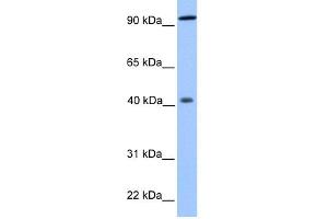 WB Suggested Anti-PYGO1 Antibody Titration:  0. (PYGO1 Antikörper  (N-Term))