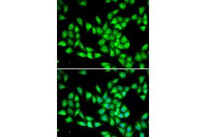 Immunofluorescence analysis of HeLa cells using PCMT1 antibody. (PCMT1 Antikörper)