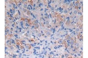 IHC-P analysis of Mouse Ovary Tissue, with DAB staining. (PROZ Antikörper  (AA 23-399))