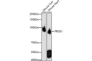 Western blot analysis of extracts of various cell lines, using PROX1 antibody (ABIN6132519, ABIN6146252, ABIN6146253 and ABIN6216882) at 1:1000 dilution. (PROX1 Antikörper  (AA 1-300))