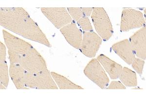 Detection of MYH1 in Mouse Skeletal muscle Tissue using Polyclonal Antibody to Myosin Heavy Chain 1 (MYH1) (MYH1 Antikörper  (AA 1585-1642))