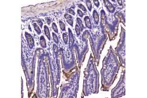 IHC analysis of Cannabinoid Receptor I using anti-Cannabinoid Receptor I antibody . (CNR1 Antikörper  (AA 1-75))