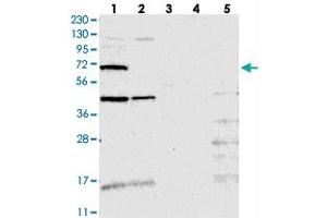 Western blot analysis of Lane 1: RT-4, Lane 2: U-251 MG, Lane 3: Human Plasma, Lane 4: Liver, Lane 5: Tonsil with TMEM87B polyclonal antibody  at 1:250-1:500 dilution. (TMEM87B Antikörper)