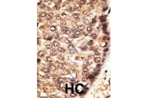 Immunohistochemistry (IHC) image for anti-Matrix Metallopeptidase 24 (Membrane-inserted) (MMP24) antibody (ABIN3002550)